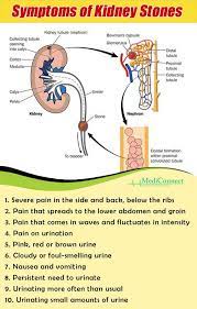 Signs And Symptoms Of Kidney Stones Kidney Health Kidney Stones Symptoms Health Tips