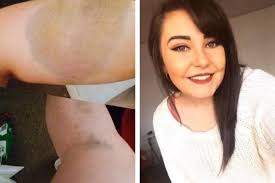 Helensburgh woman describes years of horrific domestic abuse