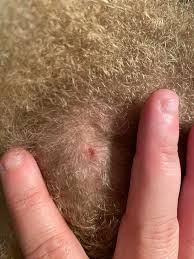 Image result for sores on the head in children