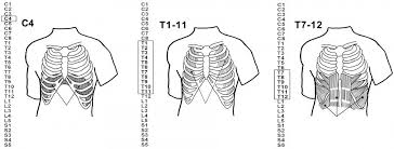 Components of backbone networks bridges, routers, gateways backbone network architectures backbone technologies best practice backbone design improving backbone. How Do Spinal Cord Injuries Affect The Body University Of Iowa Hospitals Clinics
