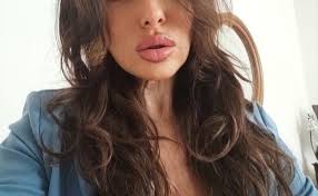 Giornata Mondiale del Malato. Anna Tortora (Azzurro Donna) "La sanità e la  scienza trovano il loro valore più pieno nel fare servizio concreto al  malato"