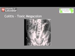 Introduction to medical conditions, processes and medical/surgical proceduresmedical terminology, the basics, lesson 3. 2 Lesson 2 D Abdomen X Ray Interpretation Lessons Blendspace