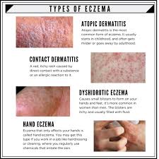 In this article, we look at 14 types from the obvious multiple choice quiz to the refreshing drag and drop format. 7 Types Of Eczema And Its Symptoms