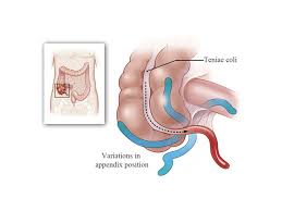 Diseases Of The Appendix Ppt Download