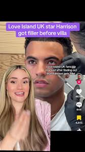 Love Island UK star Harrison got filler before villa #loveisland  #loveislanduk #WhatToWatch #loveisland2025 #realitytv