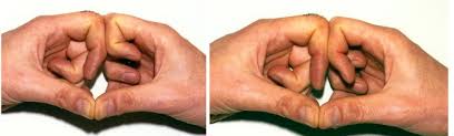 Image result for Elson Extensor Tendon Test