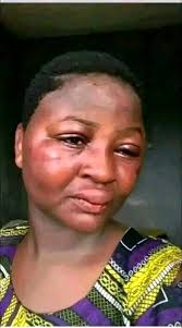 Schools defending treatment of teachers in comments