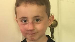 Fundraiser for Barbara Barreto by Barreto Brothers Landscaping : Mother of  three, needs help please