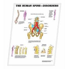 3d Anatomical Chart The Human Spine Disorders Sc00002242