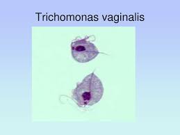 Image result for trichomonas images