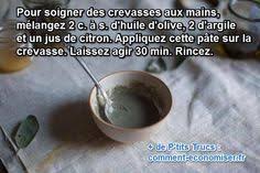 Crevasses Aux Mains Le Remede Qui Marche Pour Les Soigner Vite Crevasse Creme Pour Les Mains Remede