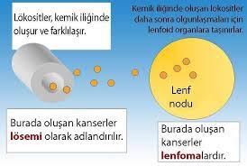 Lenf nodu, lenfatik damar boyunca uzanan küçük bir organdır. Losemi Ve Lenfoma Arasindaki Fark Nedir