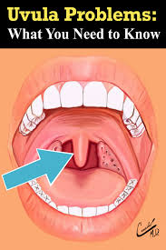 Pin On Ear Nose Throat
