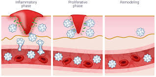 Image result for Wound Repair