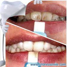 Pin On Magic Teeth Cleaning Kit