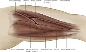 Image result for Laggera gracilis