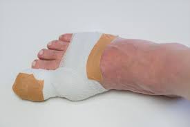 Image result for Toenail Removal