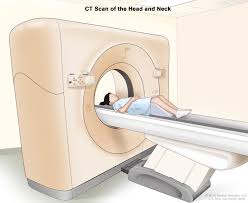 Common early symptoms will include nasal stuffiness, runny nose, and sneezing, which can all be linked to many common and minor illnesses. Childhood Laryngeal Tumors Treatment Pdq Patient Version National Cancer Institute