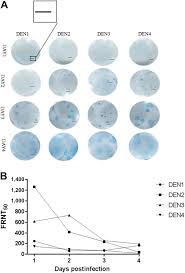 Image result for Neutralization Test