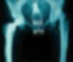 Hasil gambar untuk foto Botol Coca-Cola Di Anus