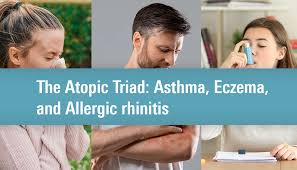 Image result for Allergic Triad