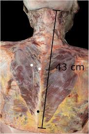It is composed of three parts: Surface Dissection Of The Back Showing The Trapezius Muscle Bilaterally Download Scientific Diagram