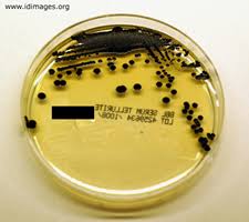 Image result for Corynebacterium