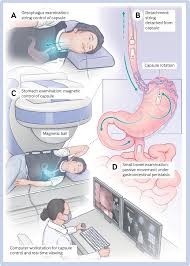 Image result for Virtual Endoscopy