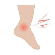 So let's have a look at the most common causes of pain on the side of the foot. Pain On The Outside Of My Foot Roseville Ankle Doctor