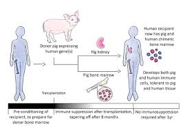Xenotransplantation Can Pigs Save Human Lives Science In The News