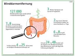 Welche behandlungsmethoden gibt es außerdem für eine blinddarmreizung? Blinddarm Op Uni Klinik Erlangen Siegt Im Nz Klinikcheck Erlangen Nordbayern