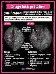Image result for Mammogram Interpretation