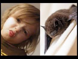 6-YEAR-OLD BOY DIES FROM RABIES AFTER BEING SCRATCHED BY INFECTED BAT