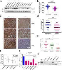 128,713 likes · 95 talking about this. Tumor Necrosis Factor A Induced Protein 1 As A Novel Tumor Suppressor Through Selective Downregulation Of Csnk2b Blocks Nuclear Factor Kb Activation In Hepatocellular Carcinoma Ebiomedicine