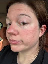 Rant: I feel lost I got diagnosed with hyperadrenergic p.o.t.s and M.C.A.S  in September. Im an extremely struggling with the adrenaline dumps. And  constant fight or flight. And