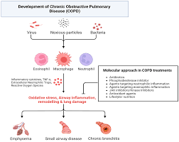 Image result for COPD Exacerbation Prevention