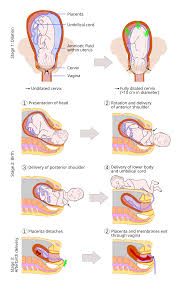 Vaginal delivery - Wikipedia