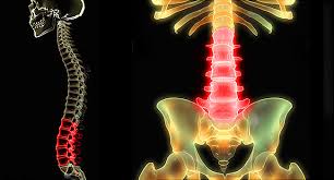 The pain usually results from problems with the musculoskeletal system—most notably the spine, including the bones of the spine (back bones, or vertebrae), disks, and the muscles and ligaments that support it. Low Back Pain Pictures Symptoms Causes Treatments