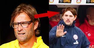 Thomas tuchel comes across as a deep thinker and someone who continually strives for improvement, but he is also a manager who likes a laugh. Schock Fur Jurgen Klopp Aus Fur Haartransplantat Wegen Ausstiegs Klausel Der Abendkurier