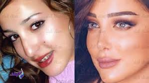 كيف تتم عملية اختراق حساب في بوك ؟ لا يحتاج المتسلل أو المخترق إلا لرقم هاتف الضحية ،والذي يرتبط بحسابه على الفيس بوك ،نعم وهنا تقع انت نفسك ضحية عملية اختراق خطيرة سوف تخسر منها جميع حساباتك المسجلة على الكمبيوتر وليس حساب الفيس بوك. Ø¨Ø³Ù…Ø© Ø¨ÙˆØ³ÙŠÙ„ Ø´Ø§Ù‡Ø¯ Ø·Ù„ÙŠÙ‚Ø© ØªØ§Ù…Ø± Ø­Ø³Ù†Ù‰ Ù‚Ø¨Ù„ ÙˆØ¨Ø¹Ø¯ Ø¹Ù…Ù„ÙŠØ§Øª Ø§Ù„ØªØ¬Ù…ÙŠÙ„