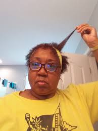 Photogenic hair growth and shrinkage results