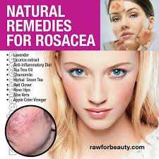 Natural Remedies For Rosacea Natural Remedies For Rosacea Rosacea Skin Care Rosacea Remedies