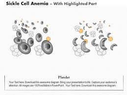 0914 Sickle Cell Anemia Medical Images For Powerpoint