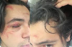 Fundraiser by Adrian Zepeda : ER Medical Bills and New Production Equipment