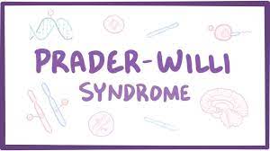 Prader Willi Syndrome Physiopedia