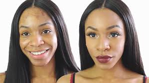 best makeup for acne scars 2016