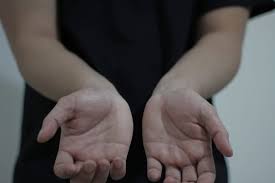 Jika ini penyebabnya, anda cukup menggunakan sabun dengan bahan yang aman dan memakai pelembap untuk tangan. Tangan Kesemutan Saat Hamil Waspada Sindrom Carpal Tunnel