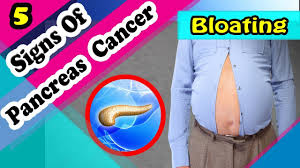 If symptoms are present, they are often vague and can be easy to ignore or linked with other health conditions. 7 Signs And Symptoms Of Pancreatic Cancer Youtube