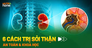 Cách trị sỏi thận: 6 phương pháp và chỉ định điều trị cụ thể