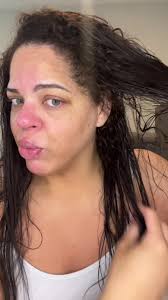 Qiqi Hair Treatment Side Effects